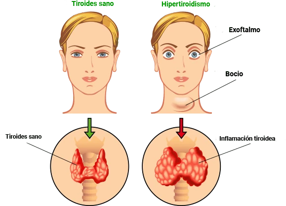 Glándula tiroides: anatomía y salud
